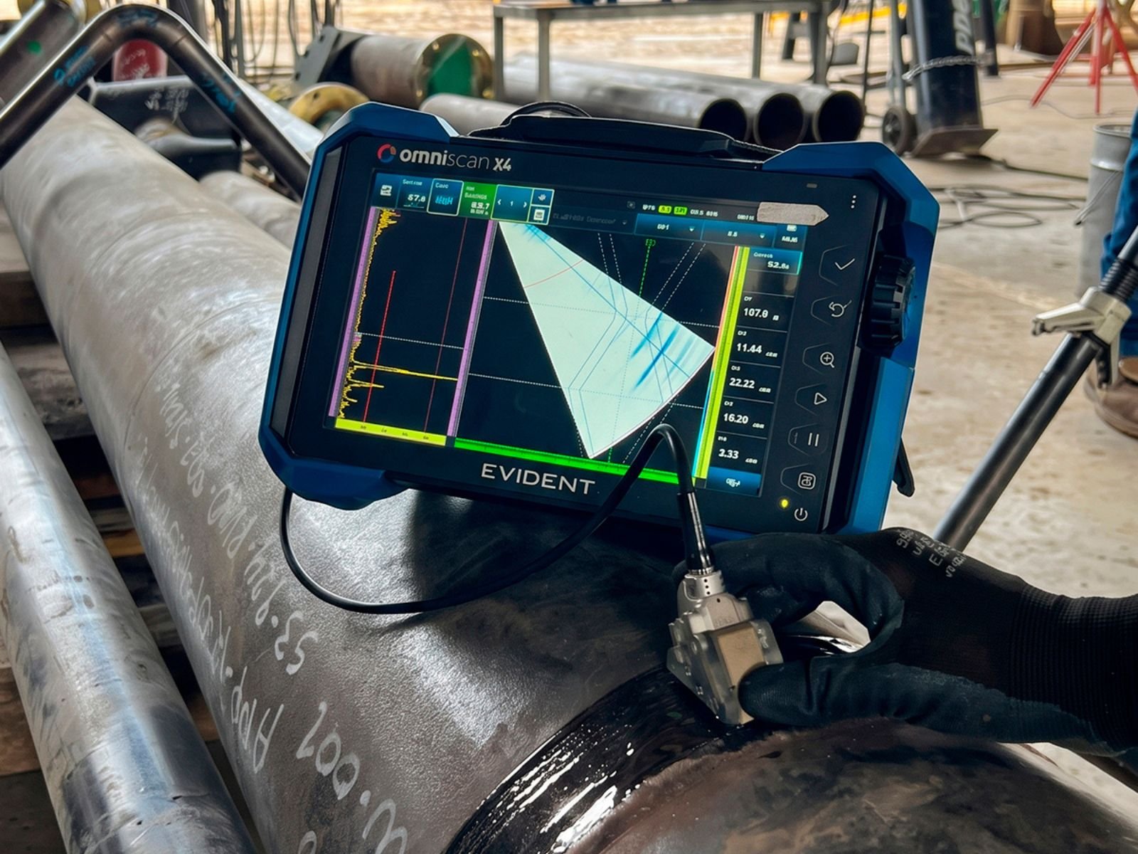 ultrasonido ende